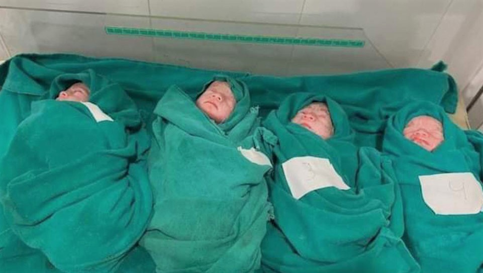 पाल्पाकी २४ वर्षीया महिलाले जन्माइन् चम्ल्याहा सन्तान